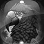 Level 35 icon