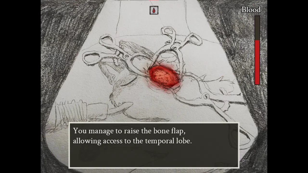 Vestal Screenshot 2