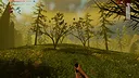 Bloodshot Eyes Screenshot 0