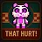That HURT!