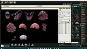 Fantasy Grounds - FG Monster Kit Aberations Art Pack Screenshot 3
