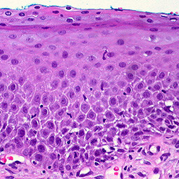 The Day The Music Died